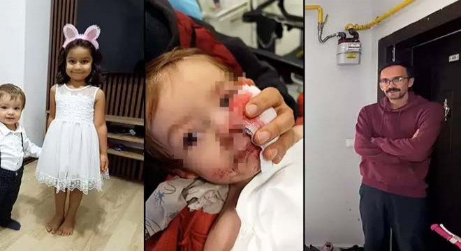 2 kardeşe saldıran pitbull ve sahibi yakalandı