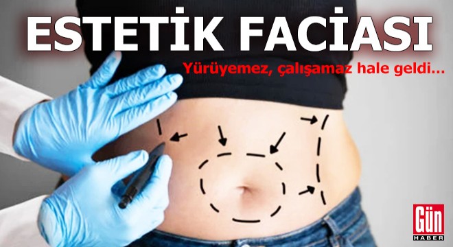 Estetik faciası: Yürüyemez, çalışamaz hale geldi