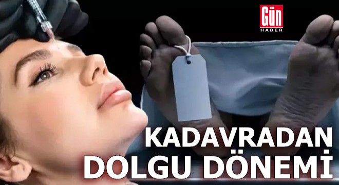 Estetikte kadavradan dolgu dönemi
