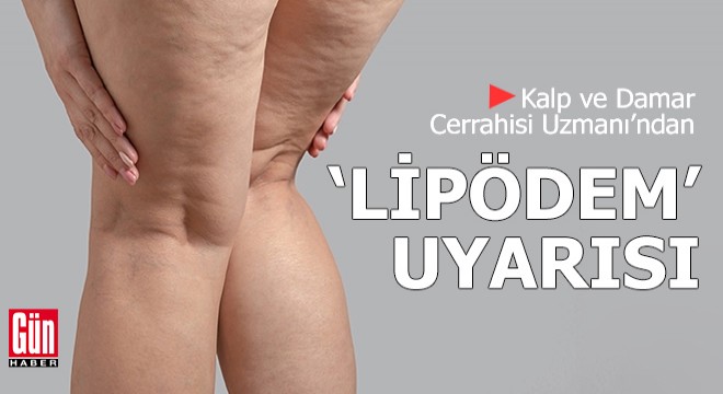 Kalp ve Damar Cerrahisi Uzmanı’ndan ‘lipödem’ uyarısı