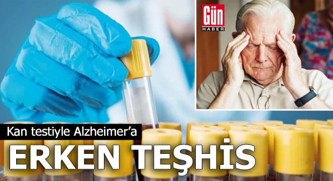 Kan testiyle Alzheimer’a erken teşhis